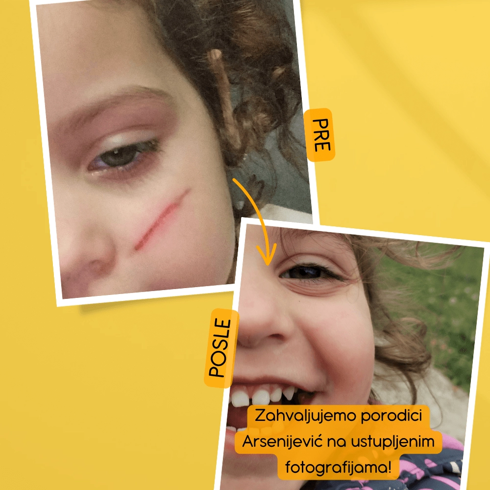 Melem od smilja pre i posle - zahvaljujemo porodici Arsenijević na ustupljenoj fotografiji. Sva prava zadržana.